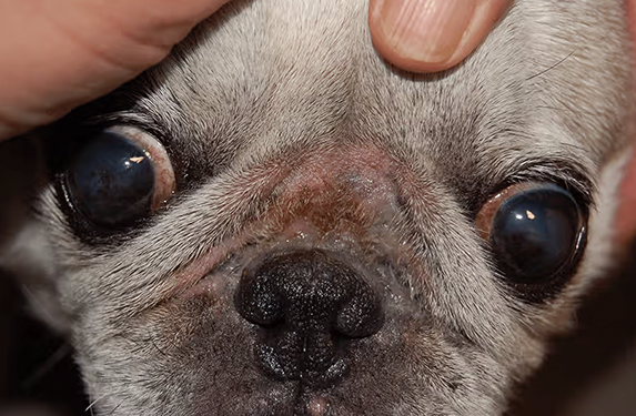 Dermatitis of the skin fold 