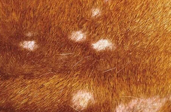 multiple focal areas with hair loss