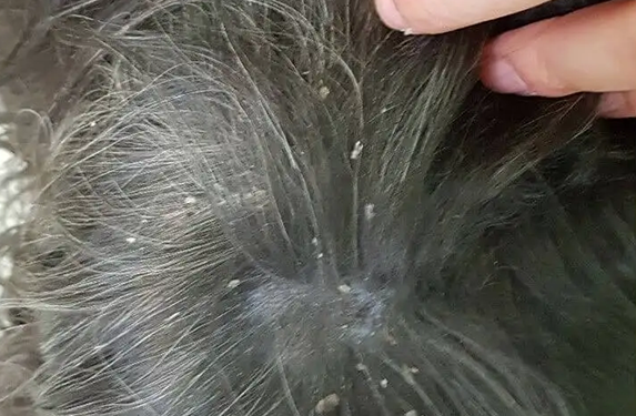 Large flakes/dandruff on the back of a dog